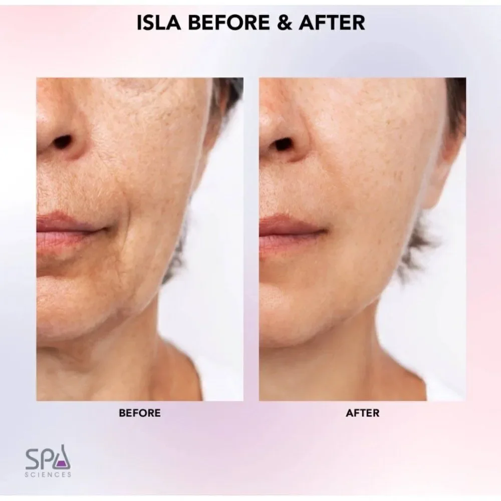 Isla provide same